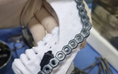 EL HOSPITAL MUNICIPAL A LA VANGUARDIA: LAS CIRUGÍAS PLANIFICADAS CON IMPRESIONES 3D YA SUPERAN LAS 60 INTERVENCIONES