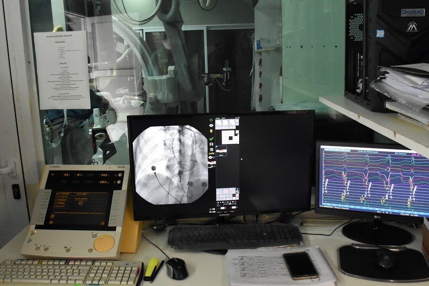 MÉDICOS ESPECIALISTAS EN CARDIOLOGÍA REALIZARON VARIOS PROCEDIMIENTOS DE ALTA COMPLEJIDAD EN LA UNIDAD CORONARIA DEL HOSPITAL PEDRO T. ORELLANA